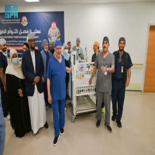 نجاح فصل التوأم الملتصق الصومالي "رحمة و رملا"